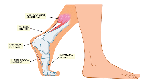 Why Does My Heel Hurt in Soccer? A Detailed Guide
