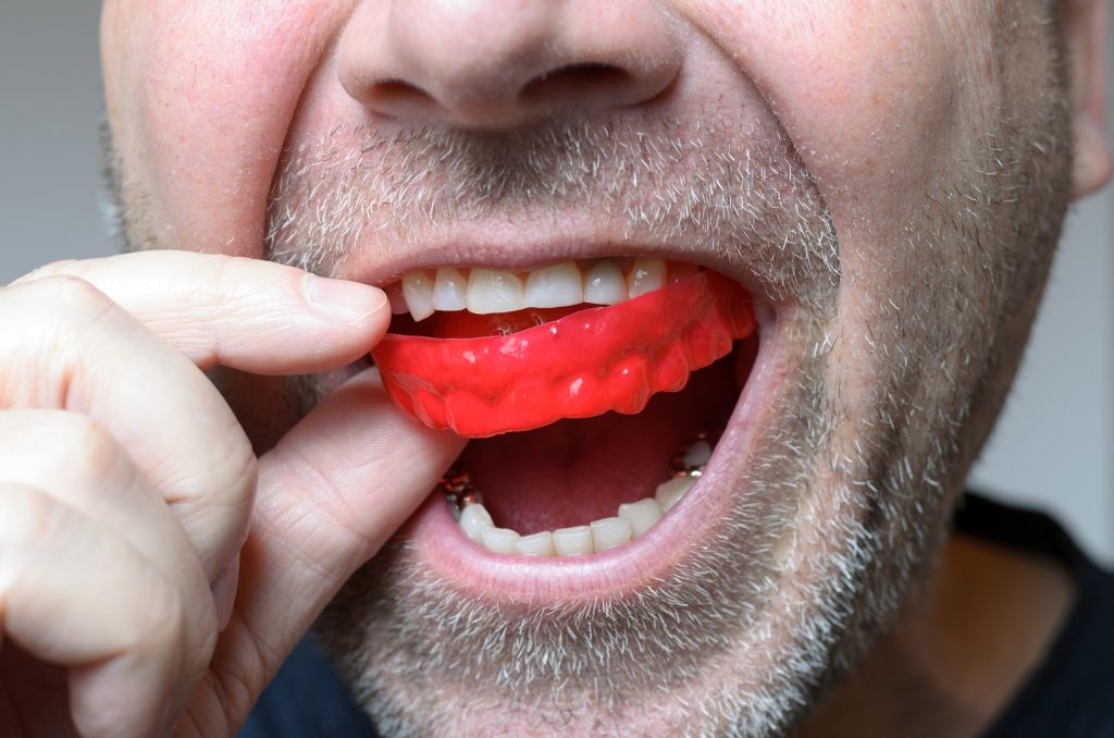 Do Soccer Players Wear Mouthguards?