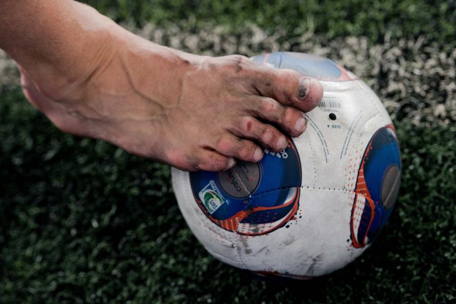 13 Simple Ways to Prevent Blisters When Wearing Soccer Cleats